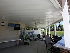 Ventilated Deck Ceiling in St. Charles, MO - St. Louis, MO 