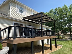 Motorized Pergola St. Louis