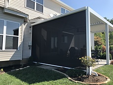 Retractable Screen Shade in St. Louis, MO